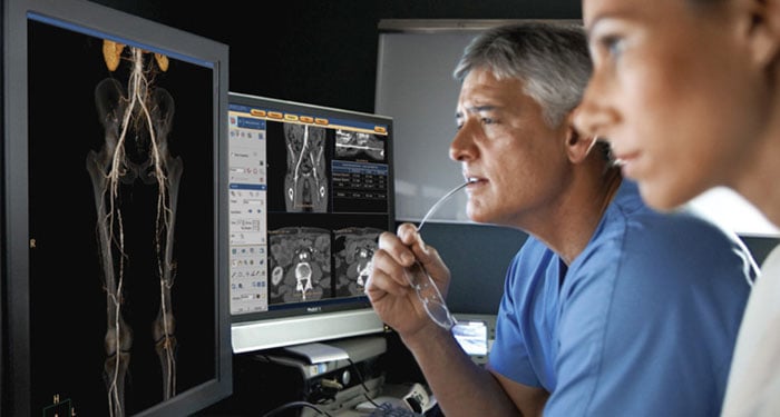 Spektral-Detektor-CT Blog | Fallbeispiele aus der Praxis | Philips Healthcare