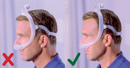 Philips DreamWear Maske zu klein