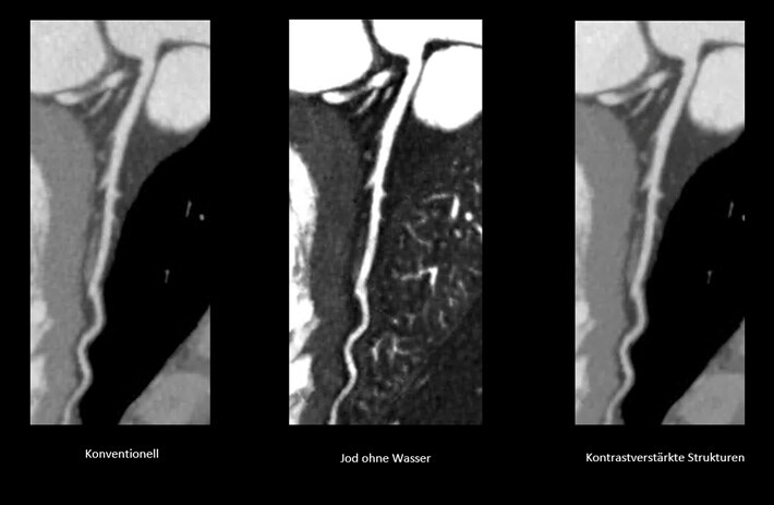 Kardiologische CTA Untersuchung