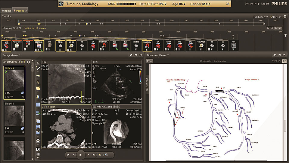 User Interface von IntelliSpace Cardiovascular​