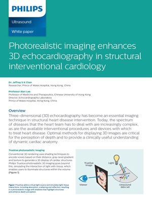 Cardiac imaging using Spectral detector CT