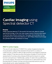 CT White Paper: Cardiac imaging using Spectral detector CT (download .pdf)