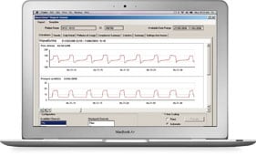 CoughAssist E70 Datenmanagement