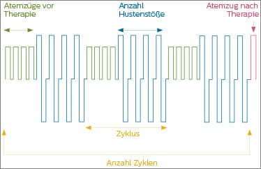 CoughAssist E70 Modus Erweitert Auto Diagramm (download .jpg)