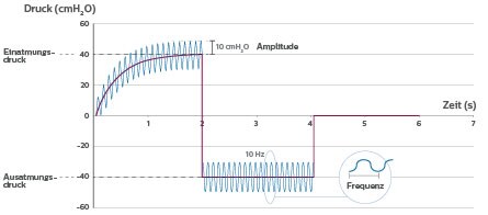 CoughAssist E70 Oszillation (download .jpg)