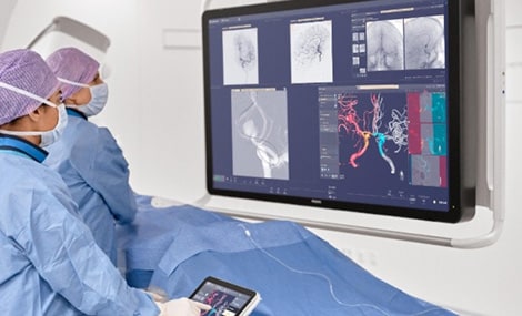 Angiographie