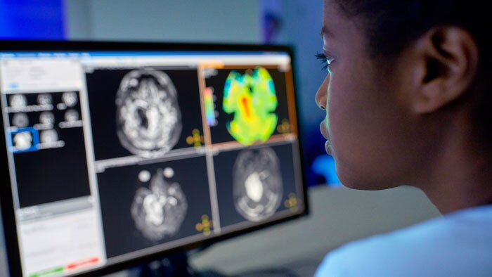 Philips Symposium – neuroRAD 2024