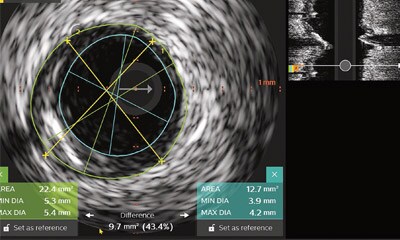 IVUS Workshop bild