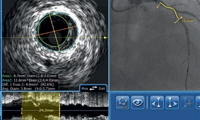 IVUS Workshop bild