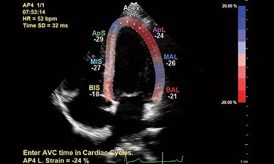 Philips US Weiterbildung Kardiologie