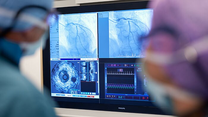 IVUS guidance