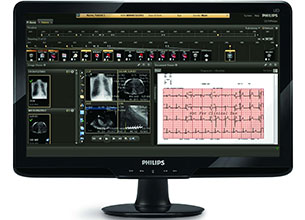 Mit Philips CVIS Informatics überwachtes EKG eines Patienten