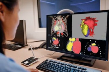 Klinikteam analysiert Patientendaten mit Hilfe von fortschrittlicher Bildvisualisierung