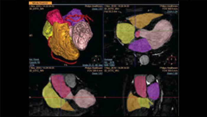 Detaillierte Scan-Bilder des Herzens in 3D