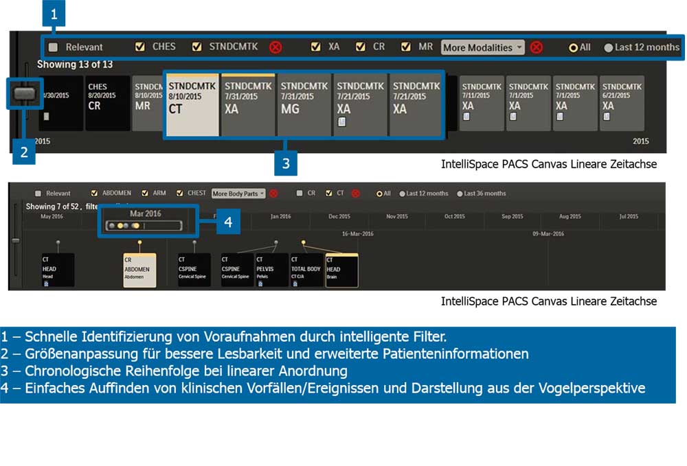 Ansicht 3 des User Interface IntelliSpace PACS​