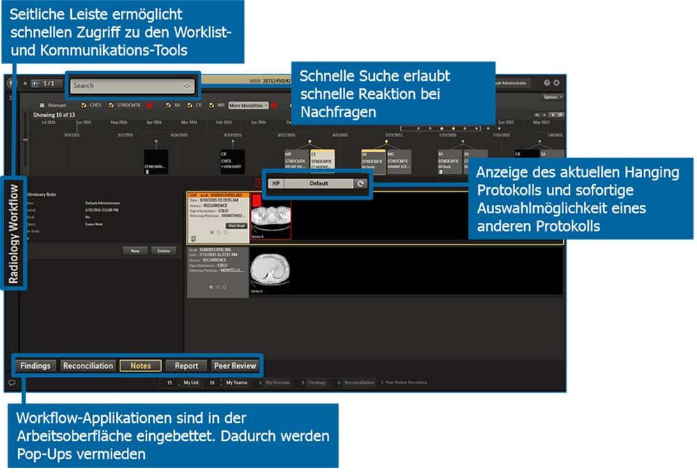 Ansicht 4 des User Interface IntelliSpace PACS​