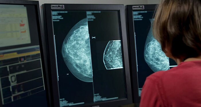 Video über die Umwandlung eines PACS-Arbeitsplatzes in einen Mammographie-Arbeitsplatz