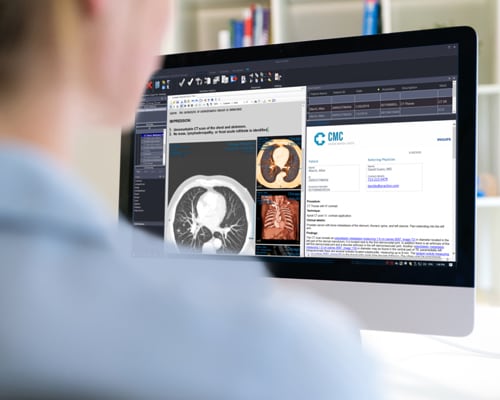 Ärztin betrachtet Perfusions-MR-Bilder am diagnostischen Bildbetrachter