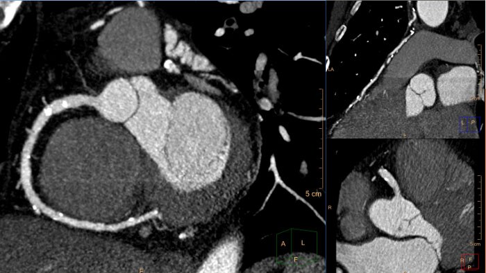 CT Cardiac Viewer