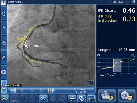 ifr coreg overview bild