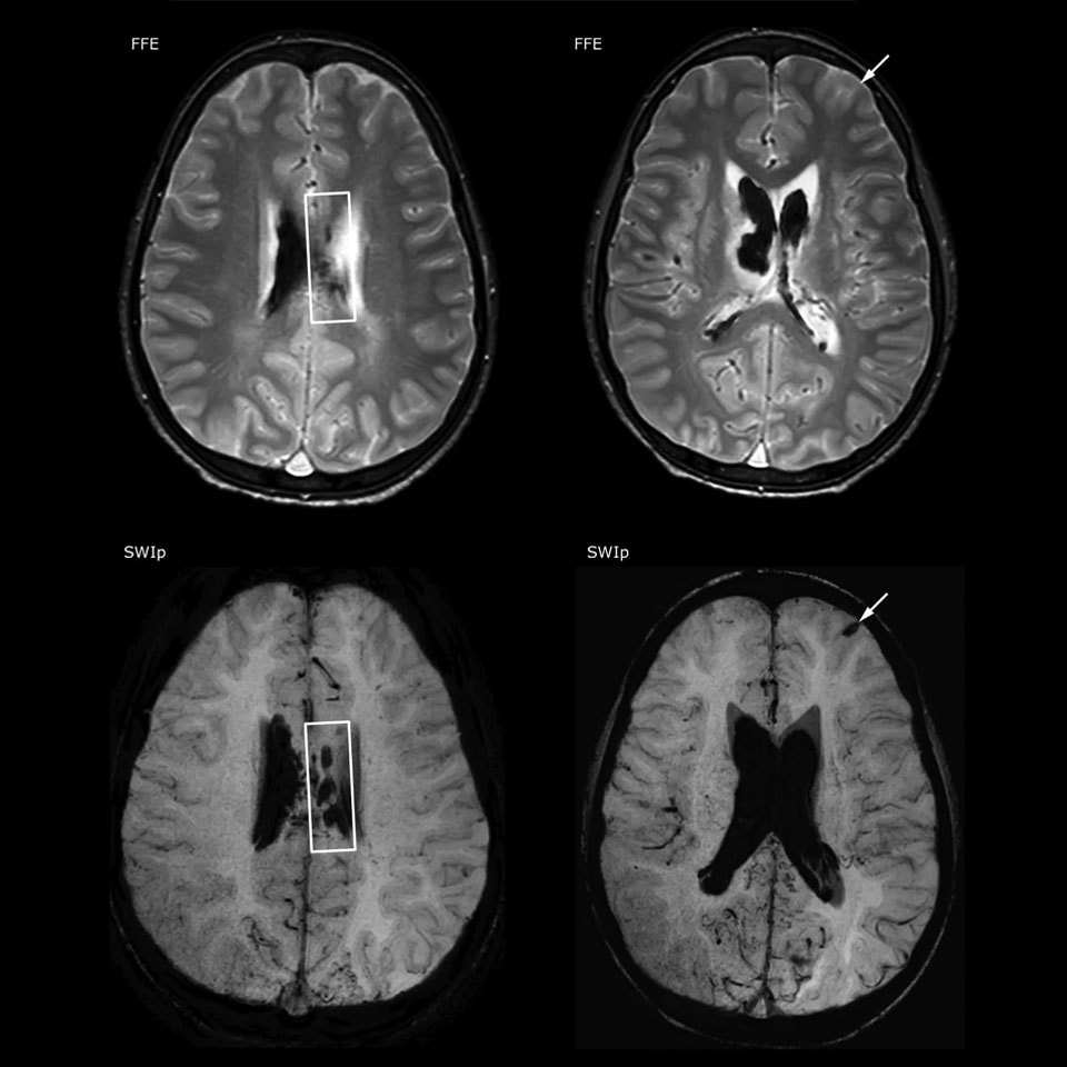 SWIp clinicalcase1