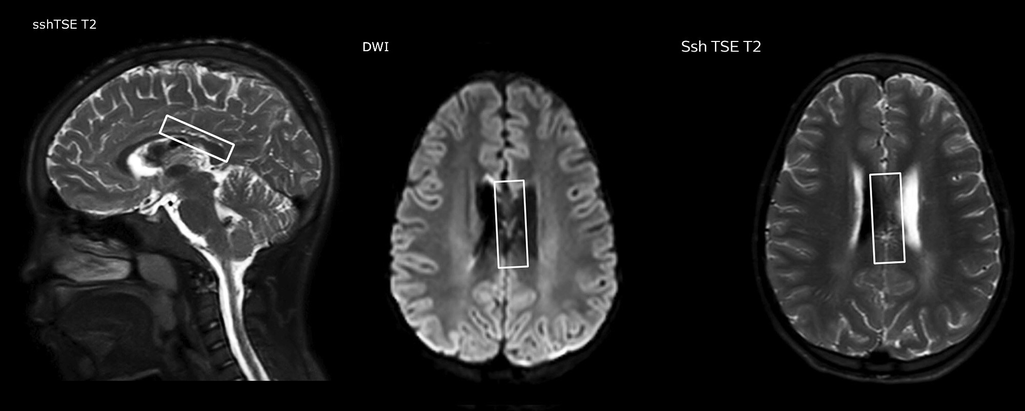 clinical case 1.1