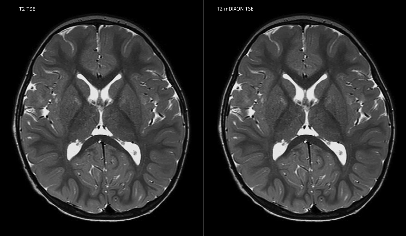 clinical case 4.1