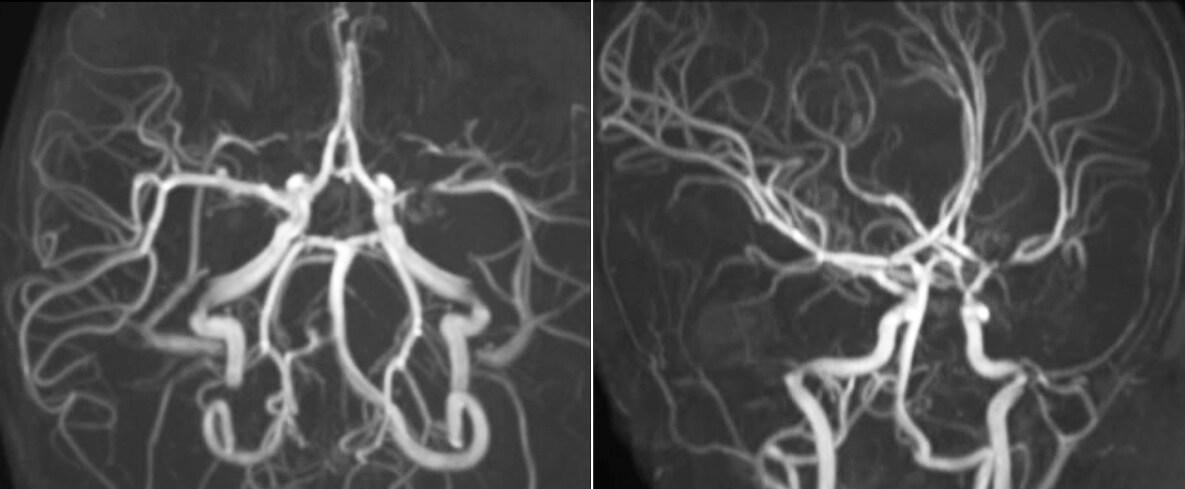 clinical case2.1