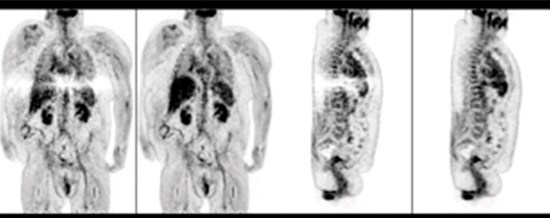 Rekonstruktion Ganzkörper-Scan mit Tail-Fitting und mit xClean im Vergleich​