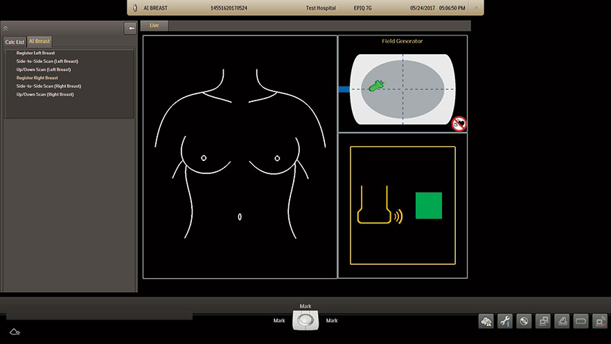 AI Breast – Registrierungsbildschirm