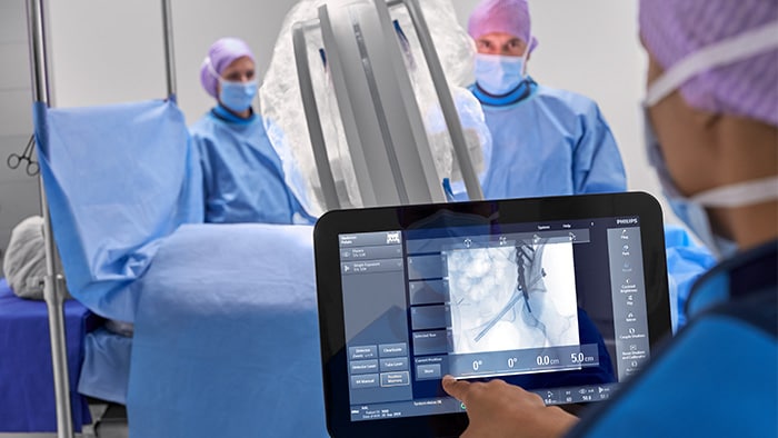 Mobile C-Bögen für die Orthopädie