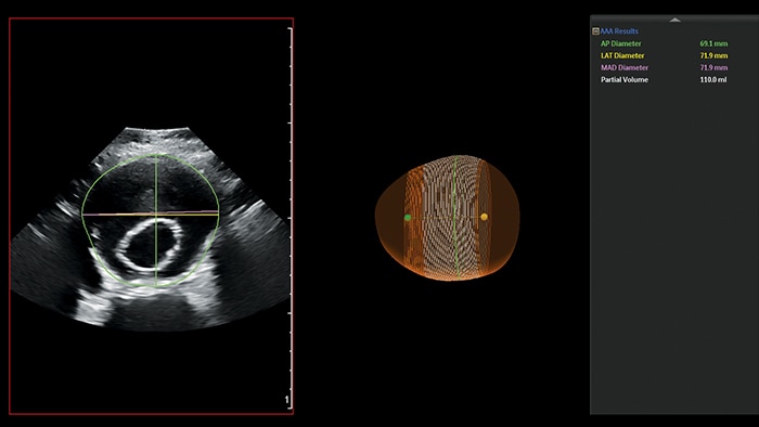 Klinisches Ultraschallbild