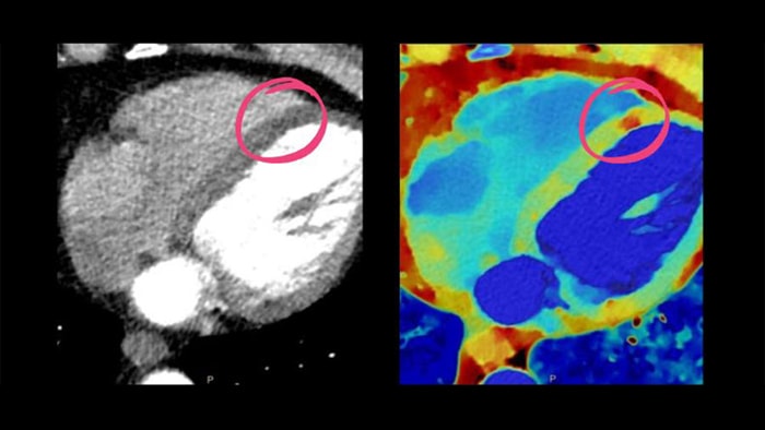 Diagnosehilfsmittel in der Kardiologie