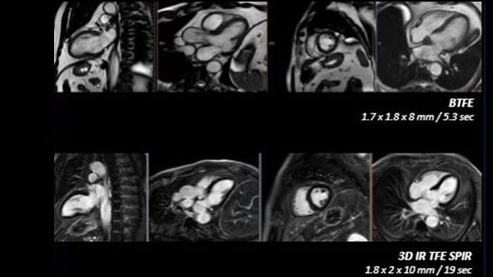 Hochauflösende diagnostische Bildgebung