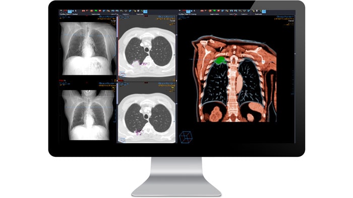 Benutzeroberfläche des radiologischen Diagnosemoduls auf einem Monitor