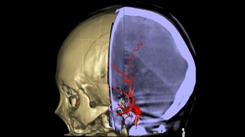 Anatomische Referenzbilder mit 3D Roadmap