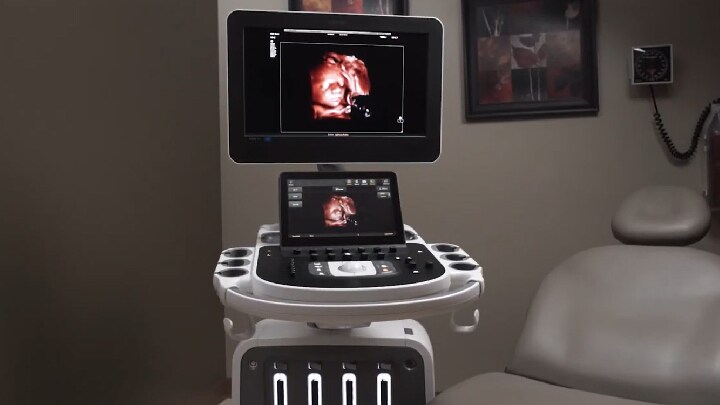 Dr. Michael Ruma stellt die Philips Ultraschallanwendungen TrueVue Pro, TouchVue, MPR Touch, Touch Sculpt, Touch Erase, Touch Zoom und aReveal vor