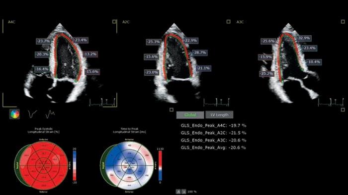 X5 1C AutoStrain-Scan