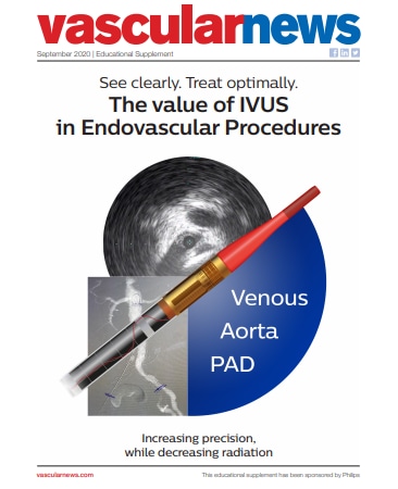 Bild PDF Mehrwert IVUS