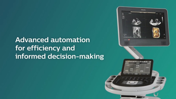 Video Vorstellung Philips Affiniti CVx für die kardiologische Routinediagnostik