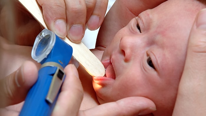 Informationen zur Zungenkinetik von Säuglingen