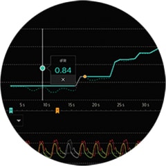 IntraSight iFR