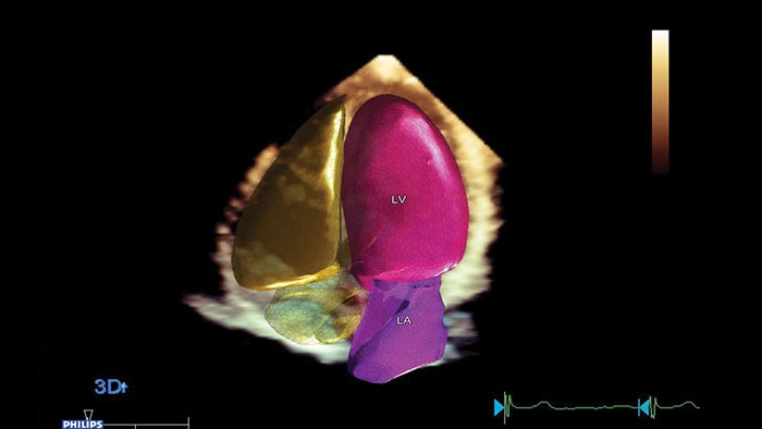 Anatomische Intelligenz für Ultraschall