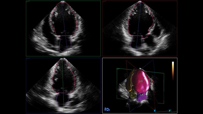 minimal user interaction-ultrasound