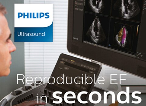 Reproducible EF in seconds – Philips EPIQ 7 HeartModelᴬ⋅ᴵ⋅ (Reproduzierbare EF innerhalb von Sekunden – Philips EPIQ 7 HeartModelᴬ⋅ᴵ⋅)