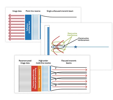 Whitepaper über Philips nSight Imaging​