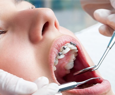 Bewertung der Vorteile des täglichen Einsatzes der Philips Sonicare bei der kiefergerechen Zahnpflege