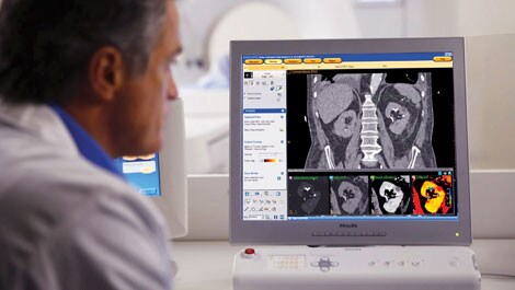 philips iqon spectral ct radiologist (öffnet sich in einem neuen Fenster)