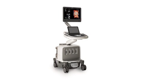 esc epiq cvx premium ultraschallsystem (öffnet sich in einem neuen Fenster)