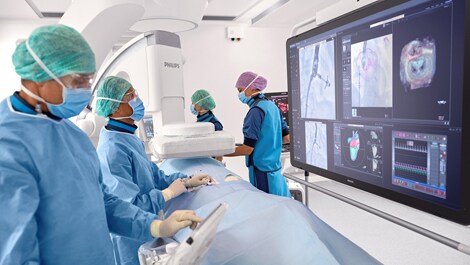philips azurion 7 c20 mit flexarm (öffnet sich in einem neuen Fenster)